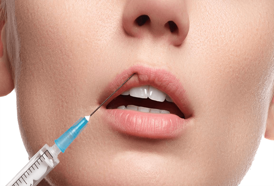 Zabiegi medycyny estetycznej — nici PDO