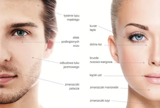 Zabiegi medycyny estetycznej — nici PDO